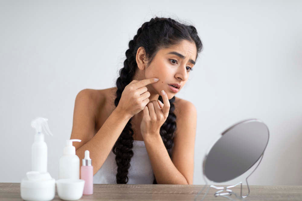 7 Cara Membersihkan Komedo Membandel Secara Optimal