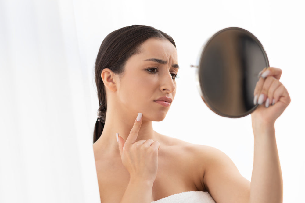 Cara Menghilangkan Komedo dengan Skincare hingga Terapi Uap